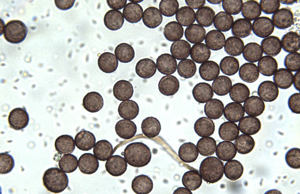 Diderma montanum (?)